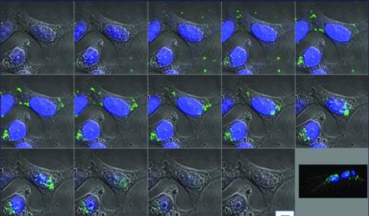 The bacterial protein DnaK (green) is taken up into human cancer cells and moves to the cell’s nucleus (blue), where the DNA is located. Source: PNAS 2018 Dec 18; 115(51): E12005–E12014.